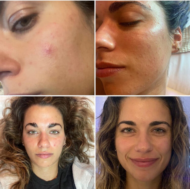 DNA Skincare results