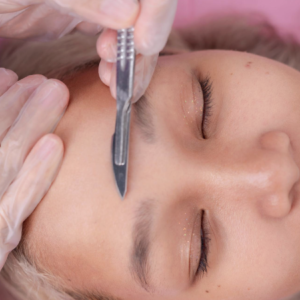 dermaplaning