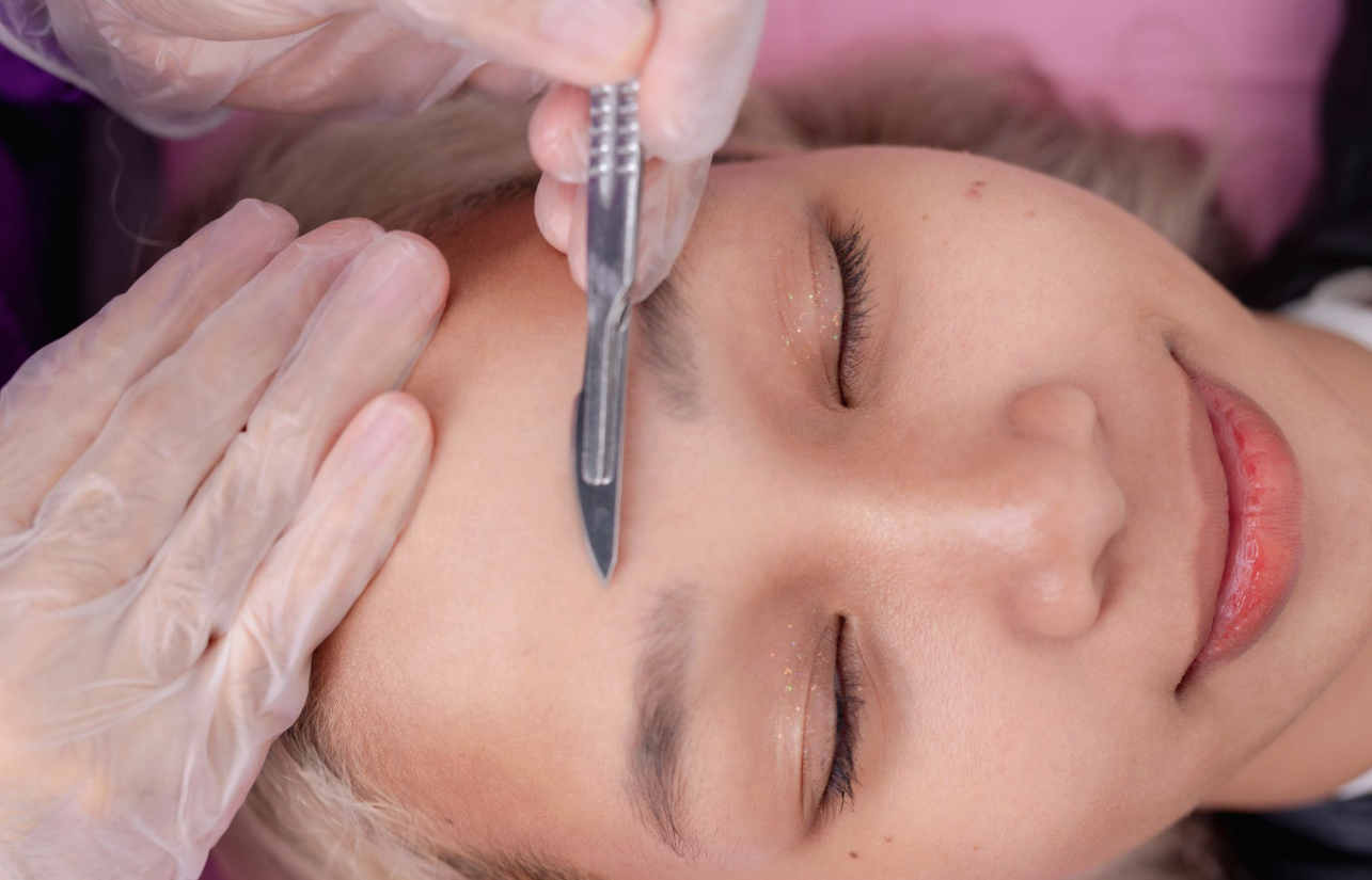 dermaplaning