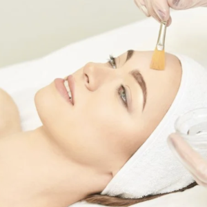 chemical peel