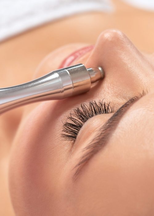 microdermabrasions